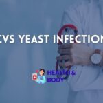 Cvs yeast infection