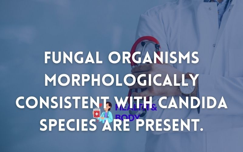 Fungal organisms morphologically consistent with candida species are present.
