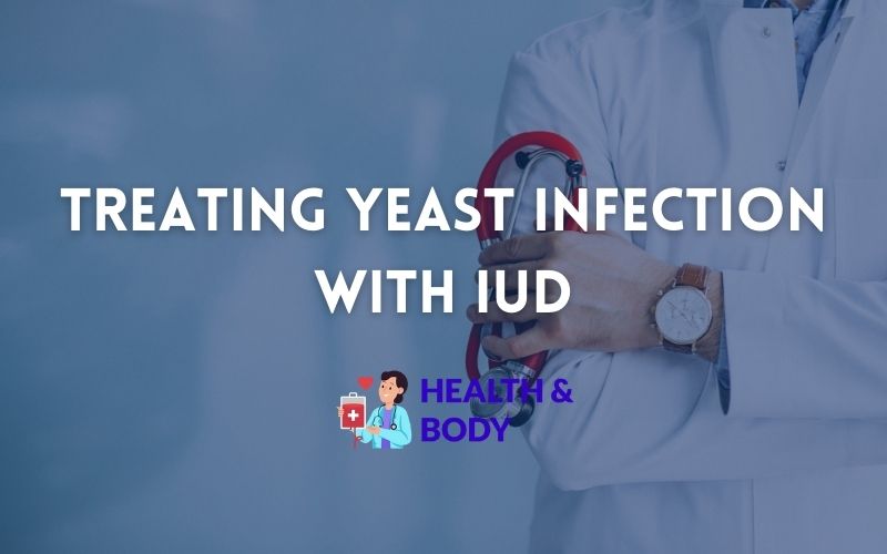 Treating yeast infection with iud